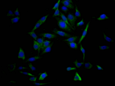 TP53 Antibody