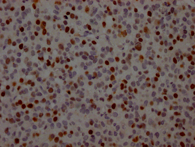 TP53 Antibody