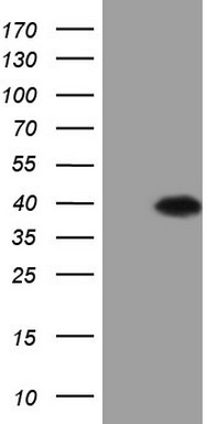 p53 Antibody