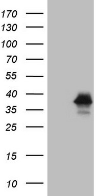 p53 Antibody