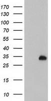 p53 Antibody