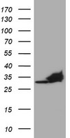 p53 Antibody