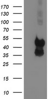 p53 Antibody