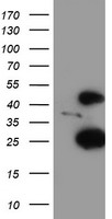 p53 Antibody