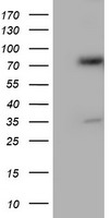 p53 Antibody
