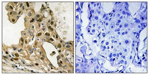 p53 (Phospho-Thr387) Antibody