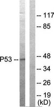 p53 Antibody