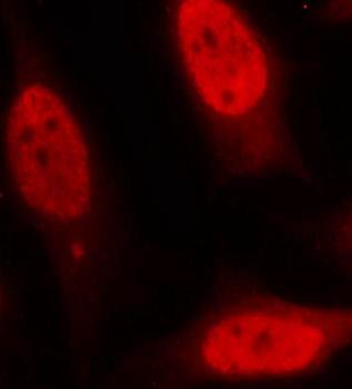 p53 (Ab5) Antibody