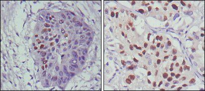 p53 Antibody