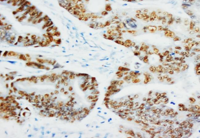 P53 Tp53 Mouse Monoclonal Antibody