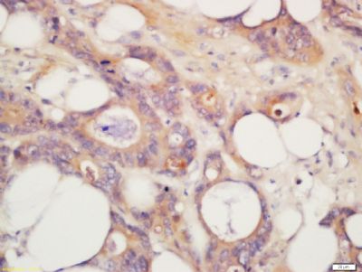 TP53I8 Rabbit Polyclonal Antibody