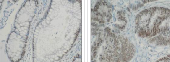 Mouse Human Heterogeneous Nuclear Ribonucleoprotein K Antibody