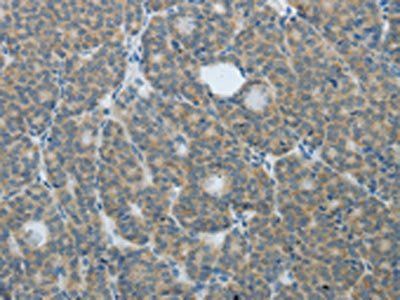TP63 Antibody