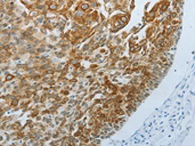 TP63 Antibody