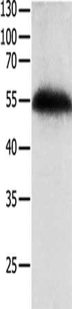 TP63 Antibody