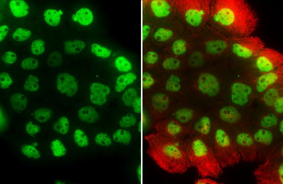 tumor protein p63 Antibody