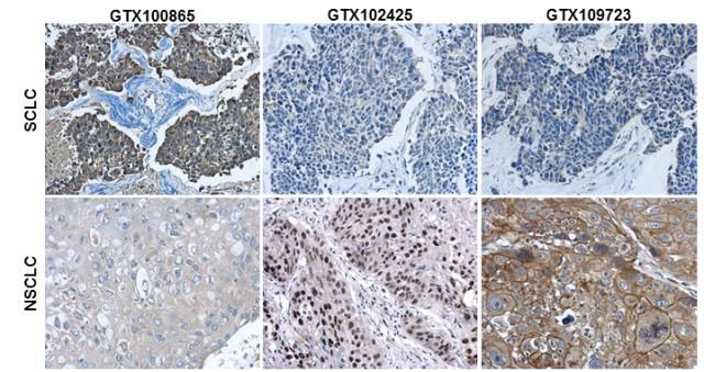 tumor protein p63 Antibody