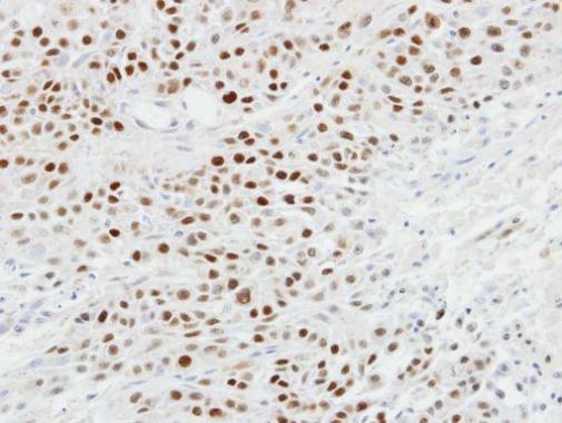tumor protein p63 Antibody