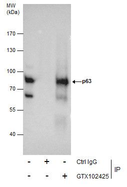 tumor protein p63 Antibody