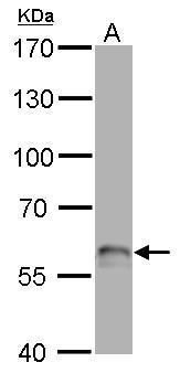 tumor protein p63 Antibody
