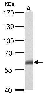 tumor protein p63 Antibody