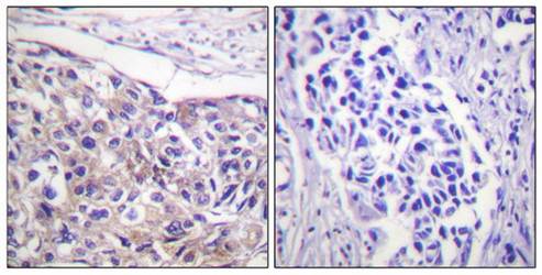 p90 RSK (Phospho-Thr573) Antibody