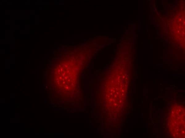 p90RSK (Phospho-Thr348) Antibody