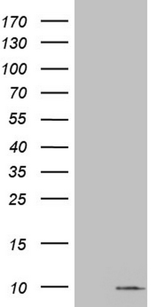 NBN Antibody