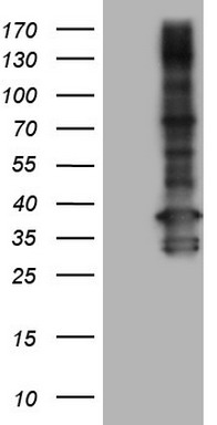 p95 NBS1 Antibody
