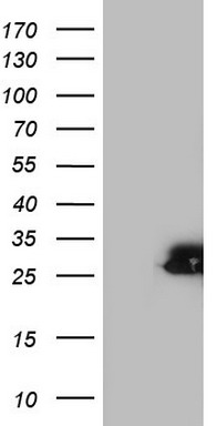 p95 NBS1 Antibody