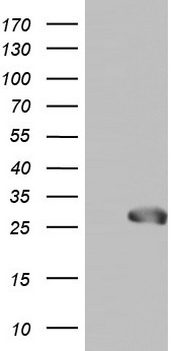 NBN Antibody