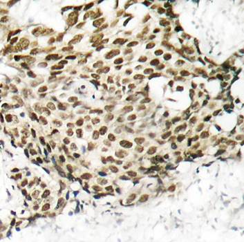 p95/NBS1 (Ab-343) Antibody