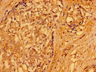 PACSIN3 Antibody