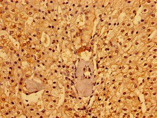 PACSIN3 Antibody