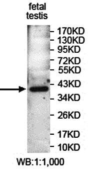 PAF Rabbit Polyclonal Antibody