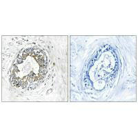 PAK1 Antibody