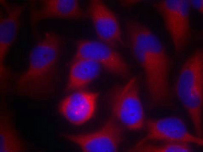 PAK1 Antibody