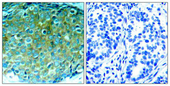 PAK1 Antibody