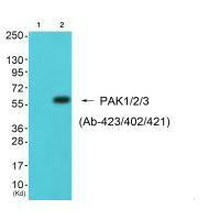 PAK1/PAK2/PAK3 Antibody