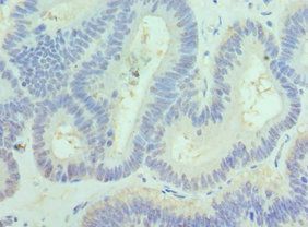 PAK1 Antibody