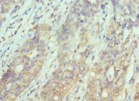 PAK1 Antibody