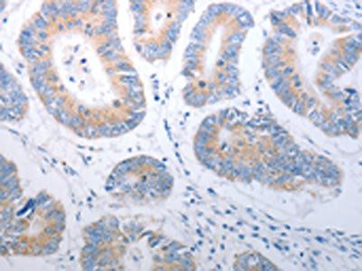 PAK1 Antibody