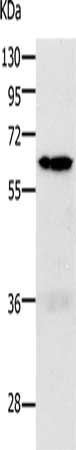 PAK1 Antibody