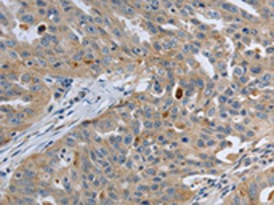 PAK4 Antibody