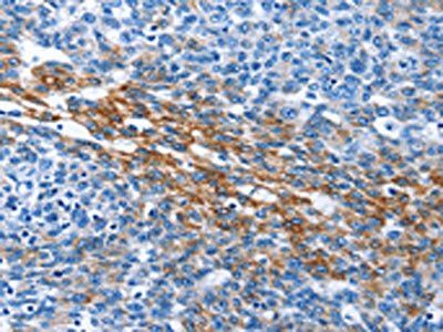 PAK6 Antibody