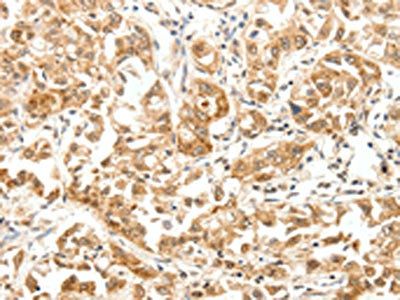 PAK5 Antibody