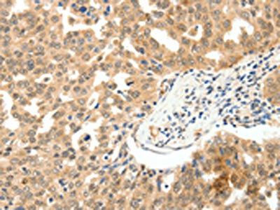 PAK5 Antibody