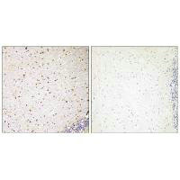 PAK5 Antibody