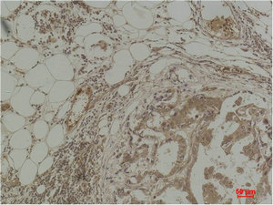 Pan Methylated Lysine Antibody