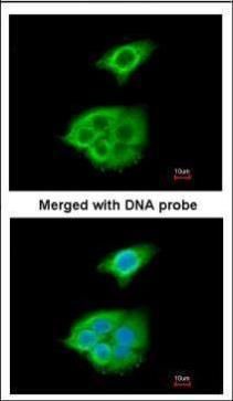 Pancreatic Lipase Rabbit Polyclonal Antibody